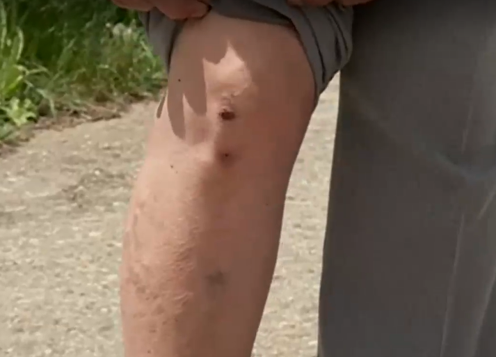 Пес нападна и наръфа до кръв възрастна жена