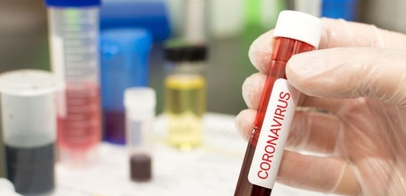 ПЪРВО В ПИК: 457 са новозаразените с коронавирус, 2 782 са излекуваните