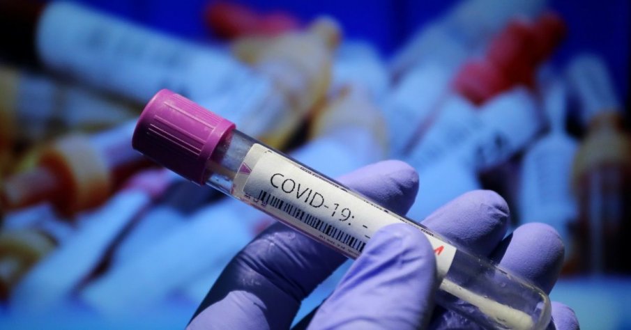 Учени съветват: Преди ваксинация си направете PCR тест