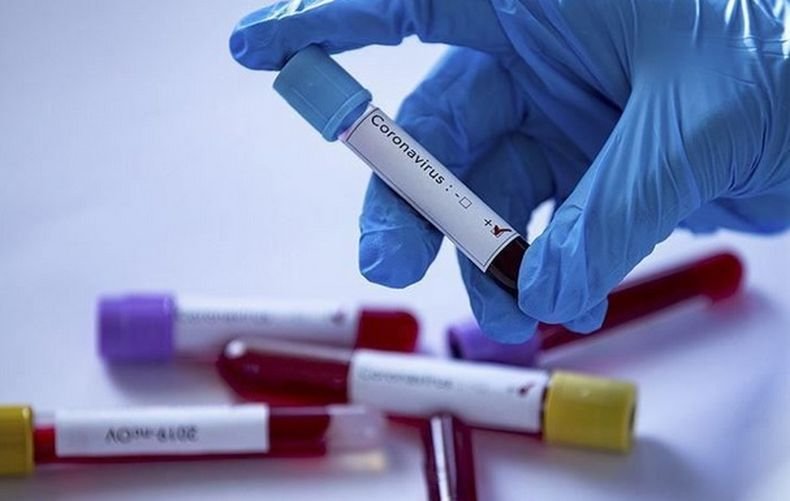 Над 79 200 новозаразени с коронавируса в Бразилия за денонощие