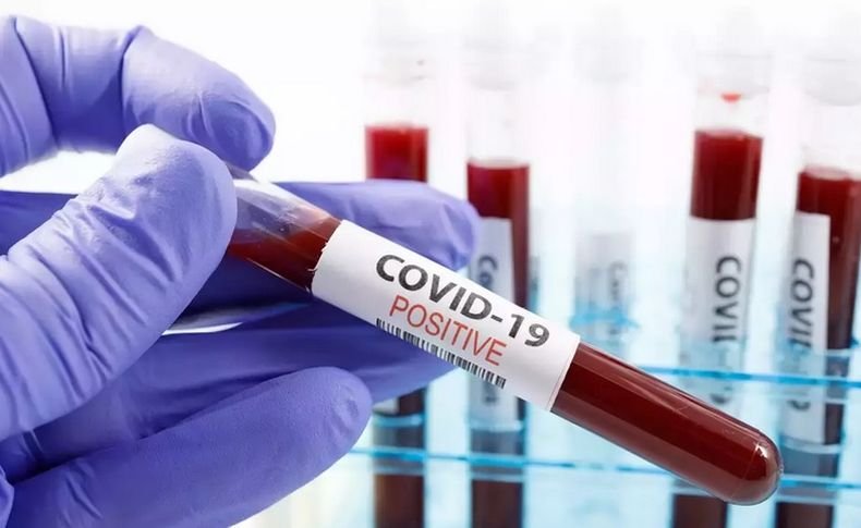 Над 12 900 новозаразени с коронавируса в Колумбия за денонощие