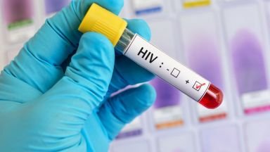4020 са българите, които живеят с вируса на ХИВ/СПИН