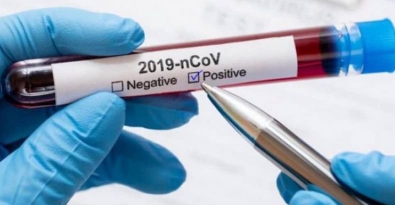 Над 23 100 новозаразени с коронавируса в Колумбия за денонощие