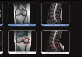 Нов мобилен рентген помага на лекарите в УМБАЛ - Бургас