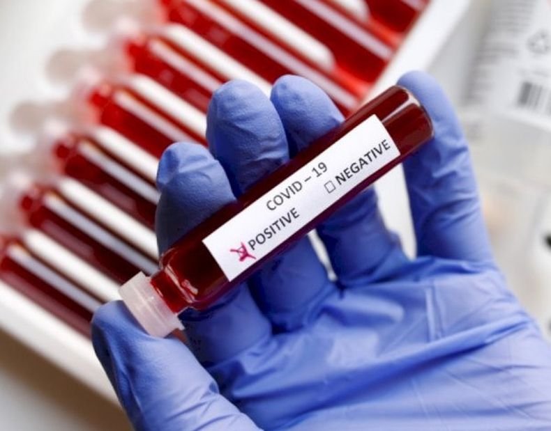 Над 21 900 новозаразени с коронавируса в Колумбия за денонощие