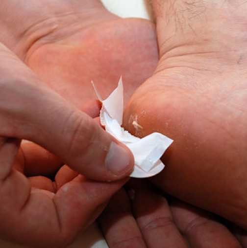 Как да извадим трънче