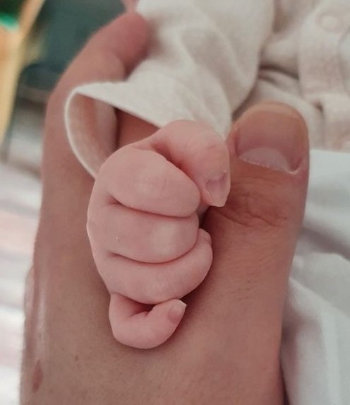 Починалото от COVID бебе родено здраво и наддавало - приели го заразено с вируса с увреждане на сърцето, бъбреците, белия дроб и с двустранна пневмония