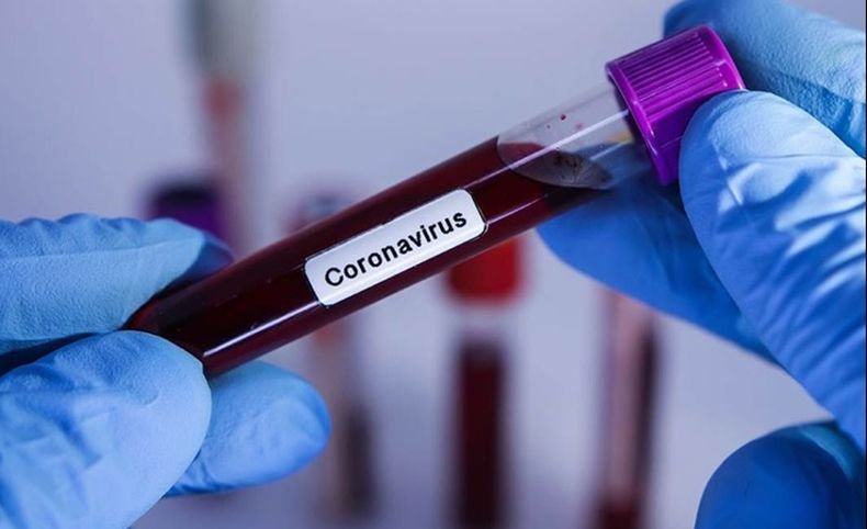 Скок на новозаразените с коронавирус в Кипър заради индийския щам