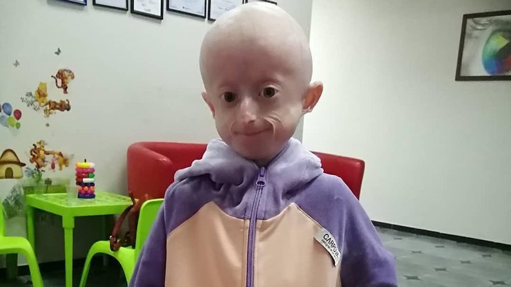 10-годишно момиченце от Украйна почина от старост