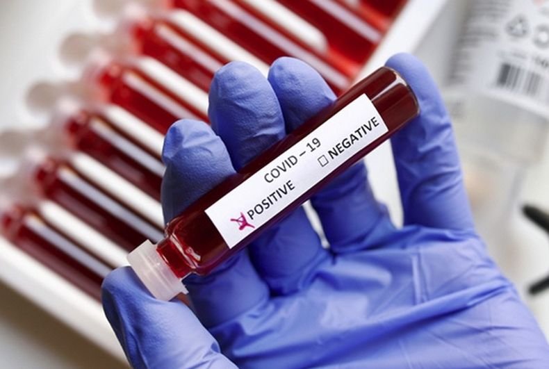 Над 27 900 новозаразени с коронавируса за денонощие в Колумбия