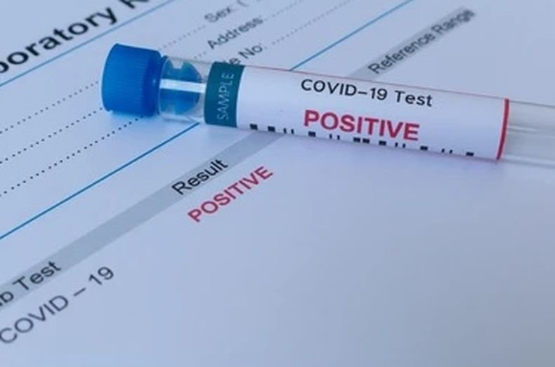 Над 22 600 новозаразени с коронавируса за денонощие в Аржентина