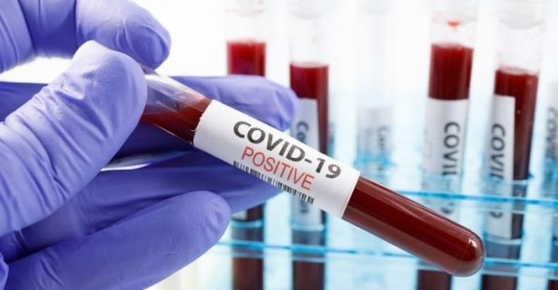 Над 18 300 новозаразени с коронавируса за денонощие в Аржентина