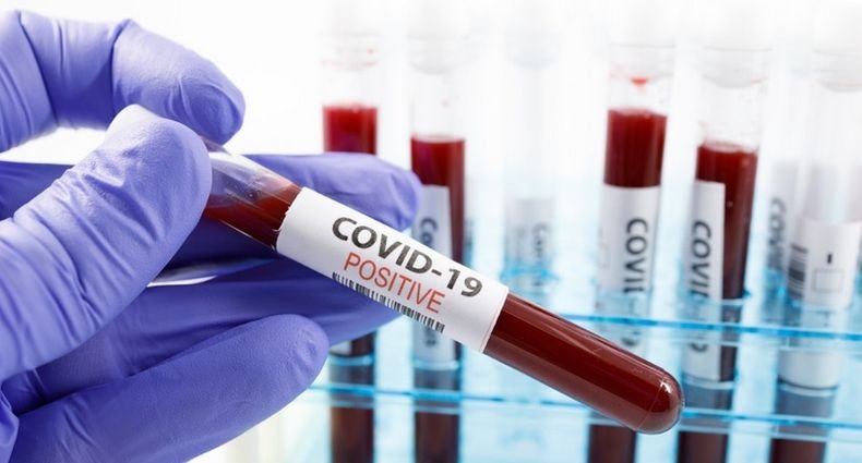 Алфа вариантът на коронавируса, засечен за първи път във Великобритания