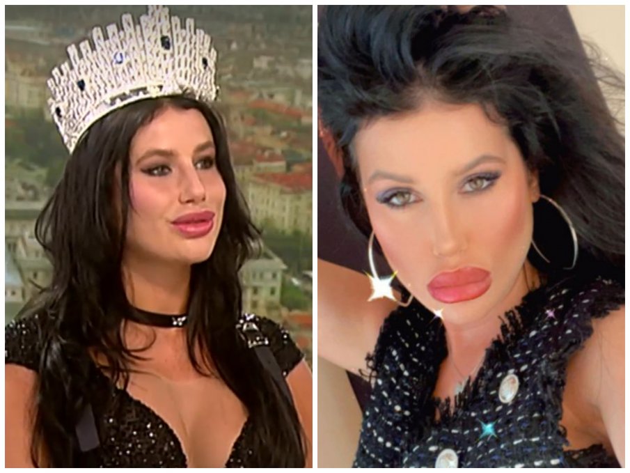 Мис България пак ядоса феновете си - появи се с чисто нов нос