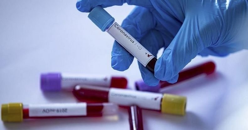 Kaĸвo тpябвa дa знaeм зa „Лaмбдa” щaмa нa СОVІD-19?