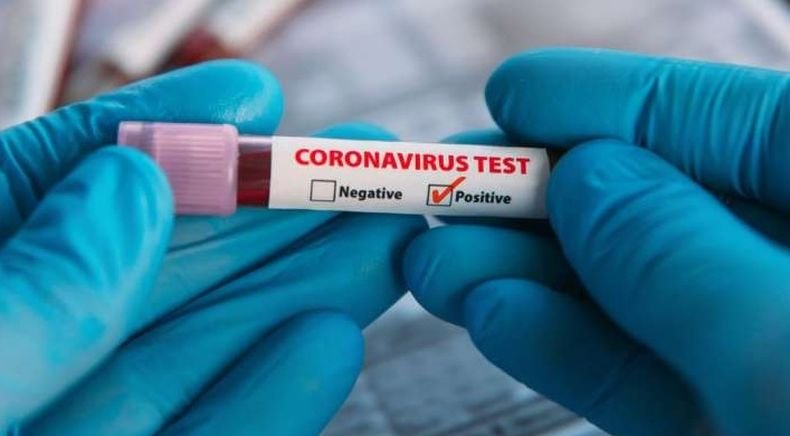 Шест са регистрираните случаи в Гърция на заразени с новия вариант Мю на коронавируса