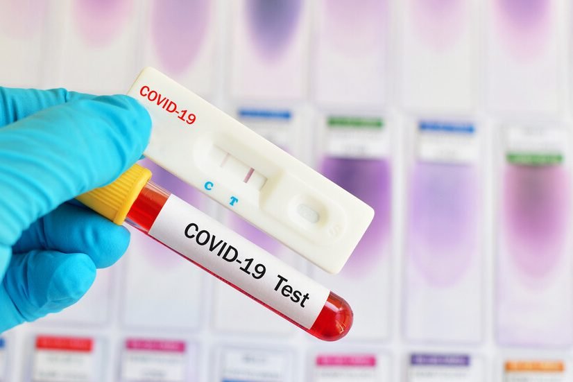 НАЙ-НОВИ ДАННИ: 10 са новите случаи на COVID-19