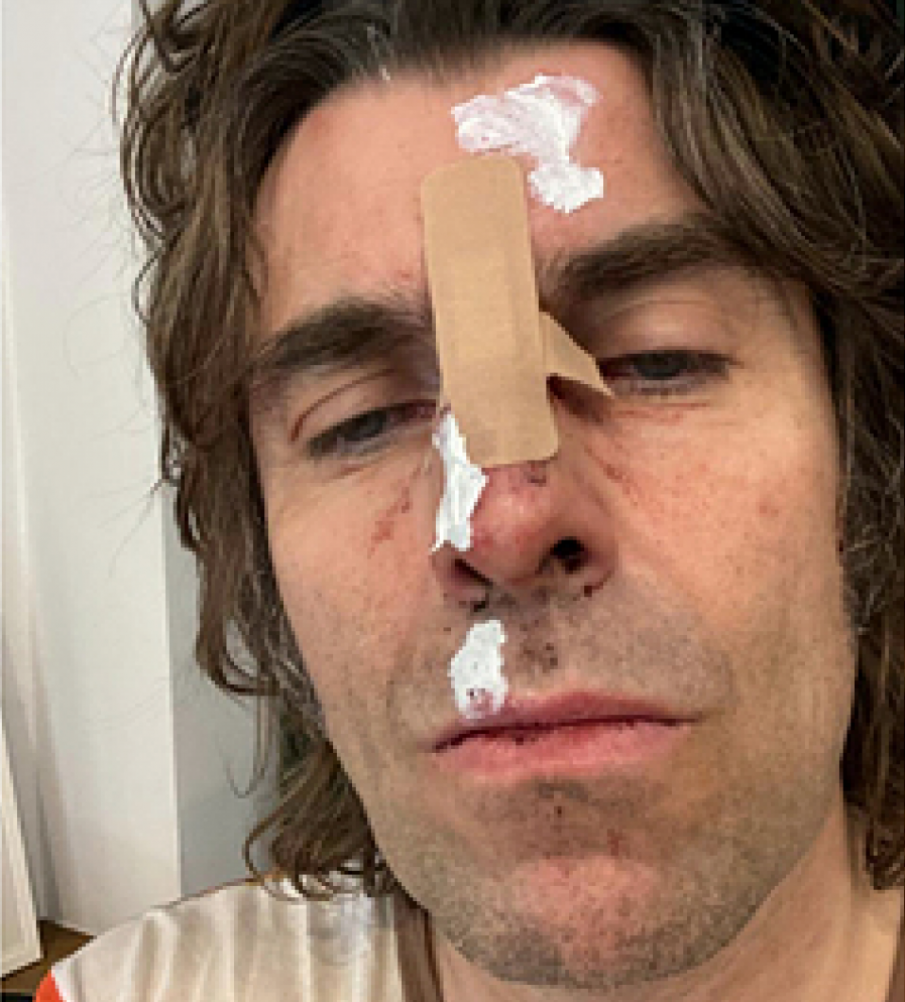 Лиъм Галахър оцеля след падане от хеликоптер