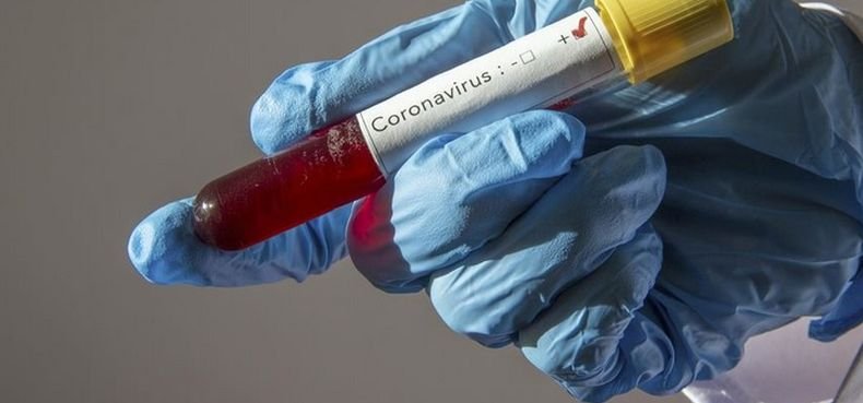 Рекорден брой нови заразени с коронавируса и починали в Русия трето поредно денонощие