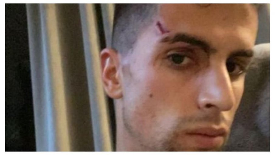 Биха и ограбиха играч на Ман Сити