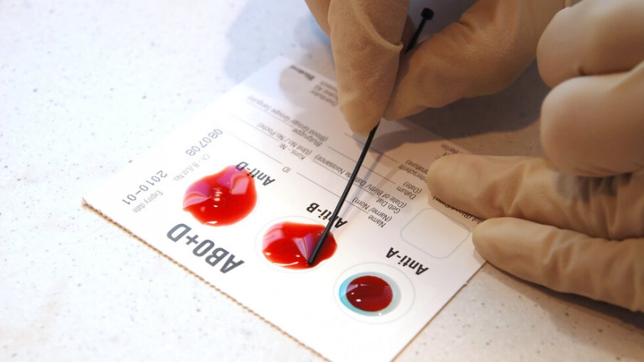 Снимка: Стана ясно коя кръвна група е най-малко податлива на COVID-19