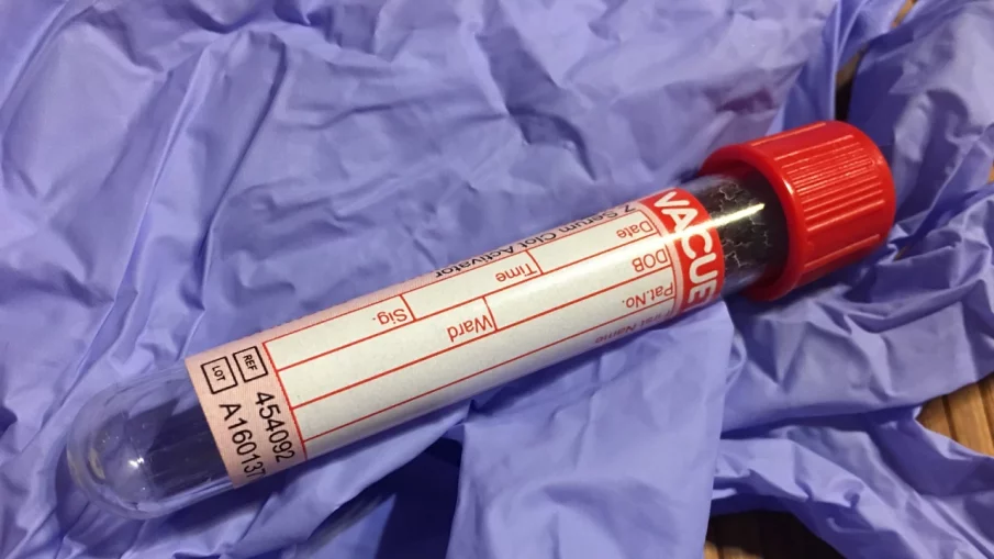 Какво е състоянието на детето със симптоми на новия остър хепатит