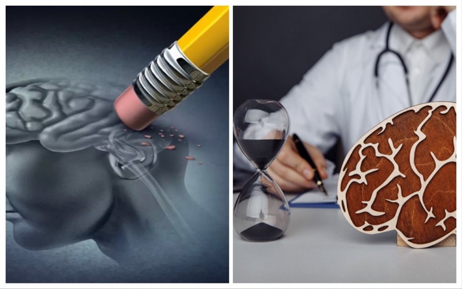 Лекар: Тази промяна в езика издава деменция