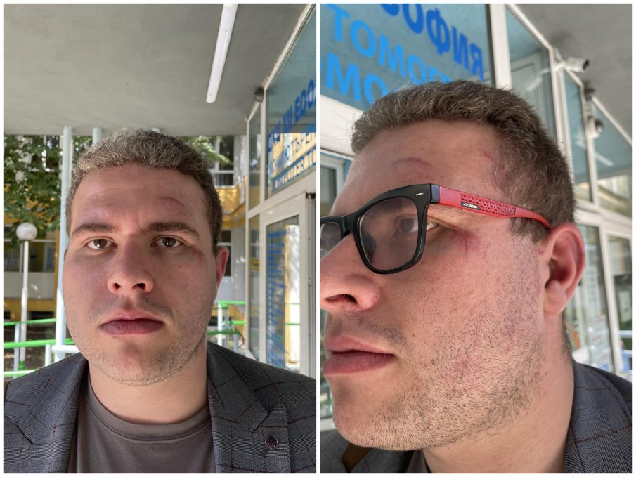 Побой над кандидат за народен представител от БСП в късните часове на Девети септември