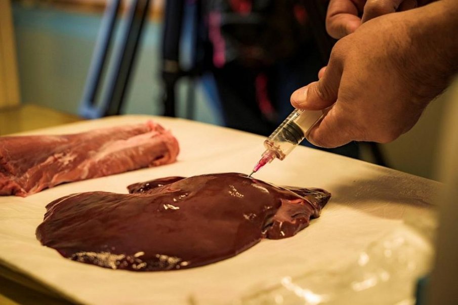 Български лекар откри иновативна модификация на биопсия