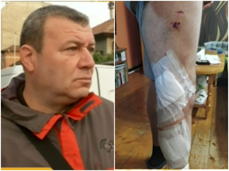 Два питбула нахапаха мъж в София, спасили го случайни минувачи