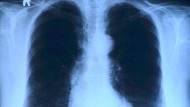 COVID-19 у нас: 266 нови случаи, един е починал