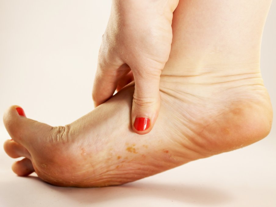 Кои са най-опасните гъбични инфекции за хората?