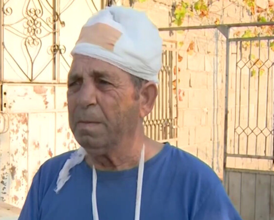 Маскиран бандит преби пенсионер с мотика, за да го обере