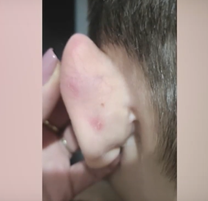 Майка твърди, че детето й е жертва на системен тормоз в детска градина