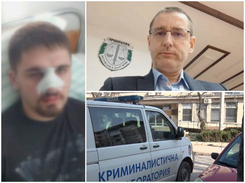 СЛЕД ПОБОЯ НАД 19-ГОДИШЕН МЛАДЕЖ В ПЛЕВЕН: Говори Окръжната прокуратура