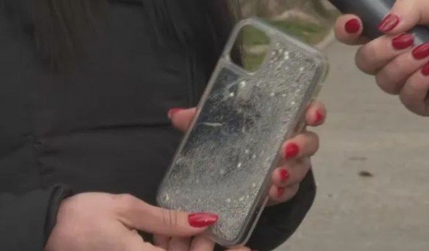 Млада жена от Пловдив с изгаряния по краката от калъф за телефон (СНИМКА)