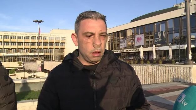 ЕКШЪН В БЛАГОЕВГРАД: Счупиха носа на служител на ГД Охрана след бой пред пиано бар