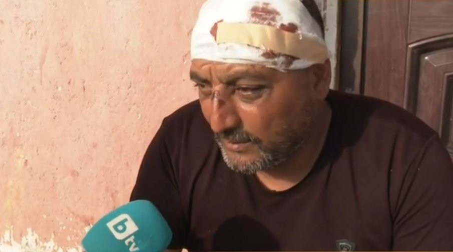 Един от пострадалите при боя с кирки в Казанлък: Нападнаха ме, когато излязох от колата