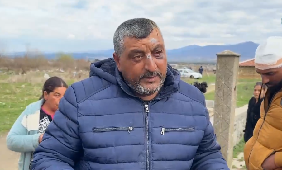 Трима от участниците в масовия бой в Казанлък – с травми, несъвместими с живота