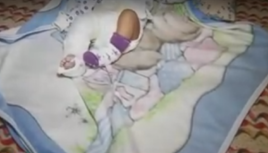 Приеха в болница бебе с жълтеница, изписаха го със счупен крак