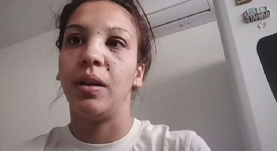 ПОРЕДЕН СЛУЧАЙ: Мъж смля от бой бившата си пред очите на детето им