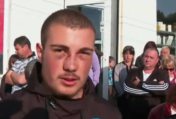 Пребиха с бокс 18-годишен младеж в село Марица