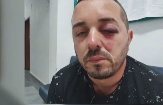 Петричанин алармира, че е бит от полицай в нощен клуб