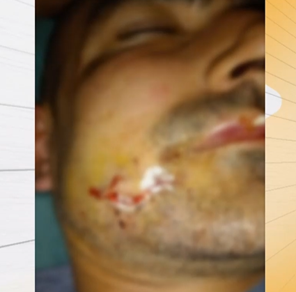 Пребиха двама мъже заради направена забележка за шум