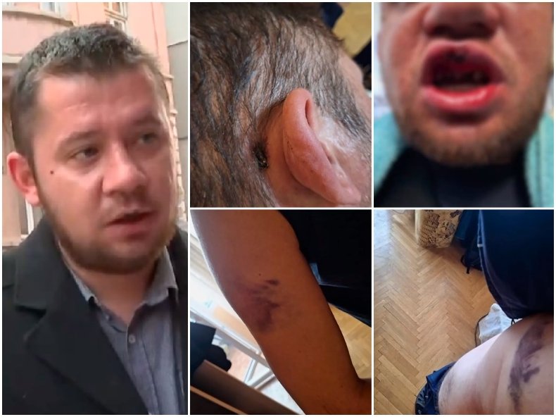 Млад мъж твърди, че е нападнат без вина от полицаи в нощта на протестите в София