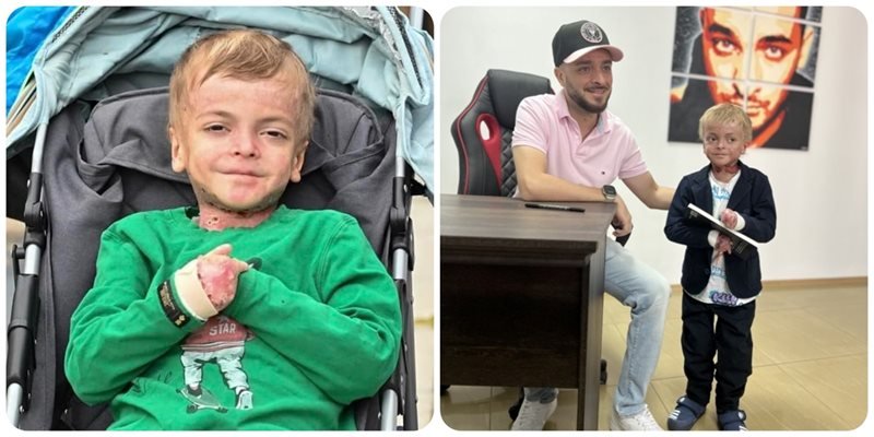 ТЪЖНА ВЕСТ: Почина пеперуденото дете Георги