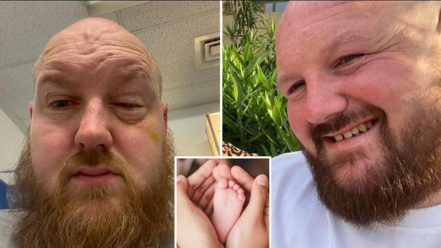 РАЗЯДЕНО ОТ КИСЕЛИНА: Мъж изгуби зрението на едното си око, докато спасява сина си