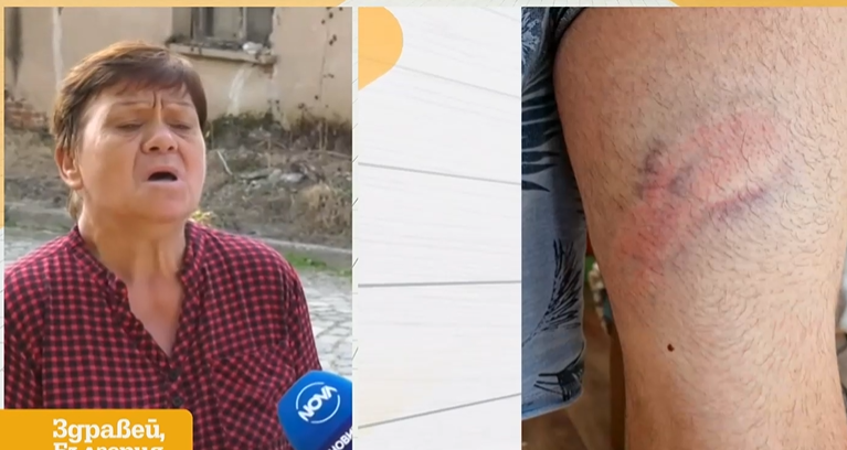 Нападнаха мъж с брадва заради силна музика