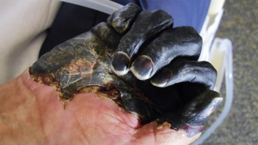 САМО ТОВА НИ ЛИПСВАШЕ: Завърна се една от най-смъртоносните болести