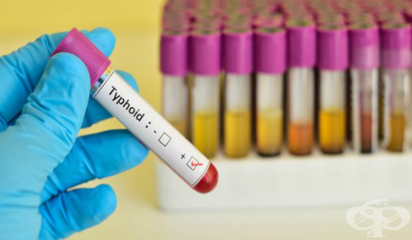 Случай на коремен тиф в Шумен